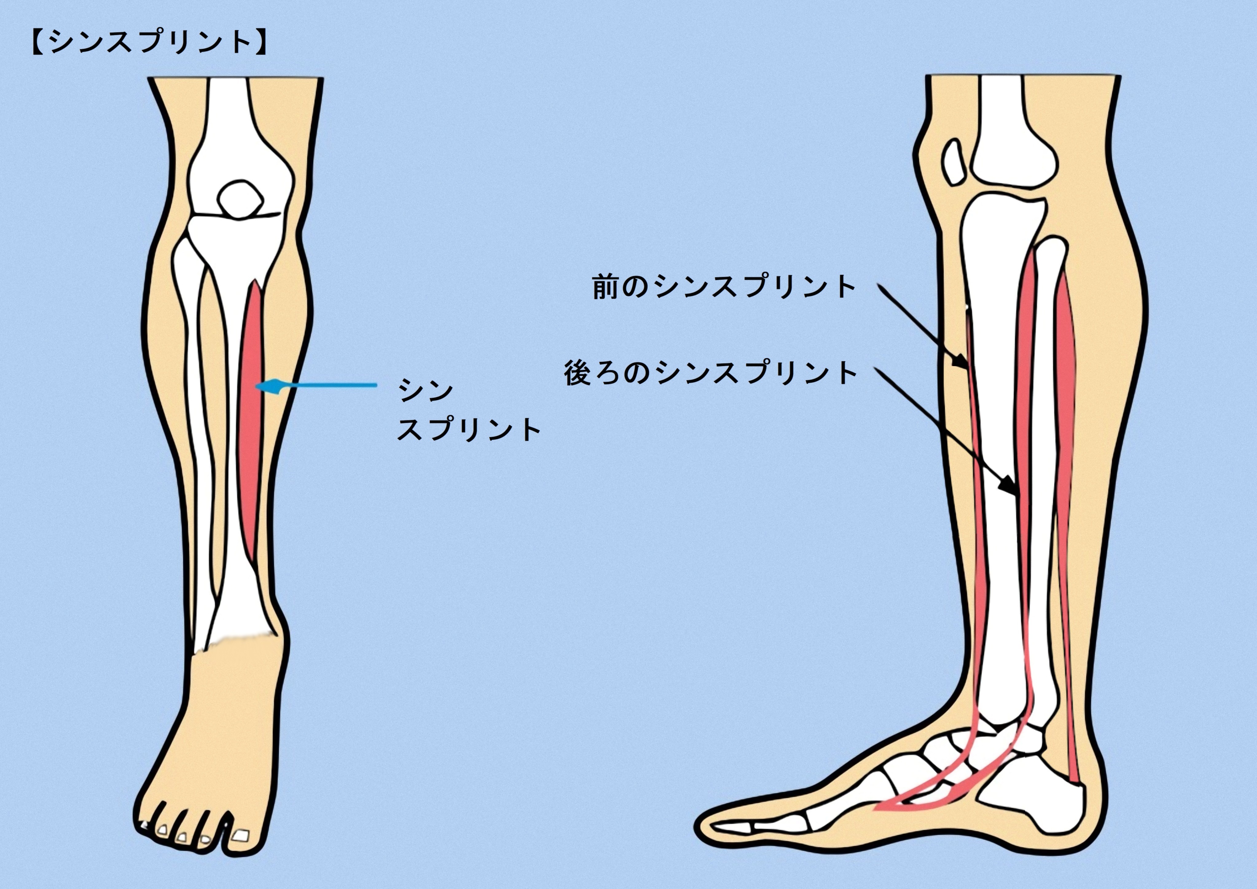 足の外側の痛みを和らげる方法