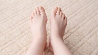 外反母趾の足の例